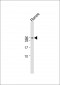 CGB/HCG-Beta Antibody (C-term)