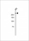 Ki-67 antibody
