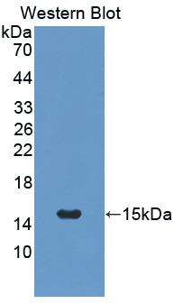 Polyclonal Antibody to Osteocalcin (OC)