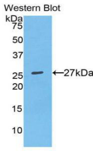 Polyclonal Antibody to Osteopontin (OPN)