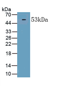 Polyclonal Antibody to Procollagen I N-Terminal Propeptide (PINP)