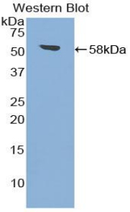 Polyclonal Antibody to Transglutaminase 1 (TGM1)