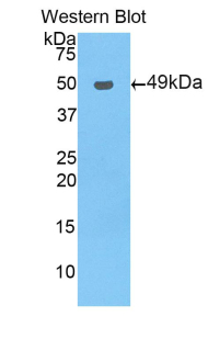 Polyclonal Antibody to Pregnane X Receptor (PXR)