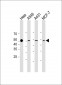 PD L1 Antibody (C-Term)