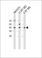 NKX2-1 antibody