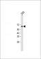 KRT1 Antibody (Center)