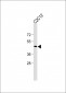 PD L1 Antibody (C-Term)