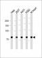 HADHA Antibody (C-term)