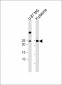 IL6 Antibody (Center)