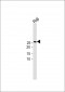 AK4 Antibody (Center)