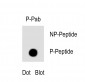 Phospho-TBK(S172) Antibody