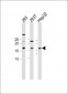 CDKN2A antibody