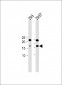 CDKN2A antibody