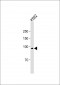 hSTAT5-pY694 Antibody