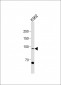 hSTAT5-pY694 Antibody