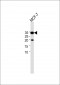 CYB561 antibody