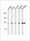 BAP1 Antibody (N-term)