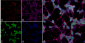 Thyroid Hormone Receptor Antibody