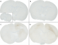 Alpha Synuclein Antibody (pSer129)