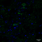 Tau Antibody (pSer202/ pThr205)