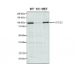 VPS35 Antibody