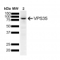 VPS35 Antibody