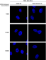 VPS35 Antibody