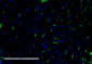 VPS35 Antibody