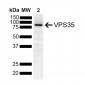 VPS35 Antibody