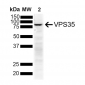 VPS35 Antibody