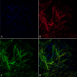 Tau Antibody