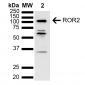 ROR2 Antibody