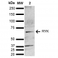 RYK Antibody