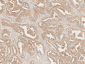 Axin-2 Antibody