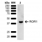 ROR1 Antibody