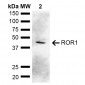 ROR1 Antibody