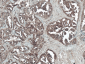 TSC2 Antibody