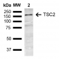 TSC2 Antibody