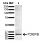 PDGFB Antibody