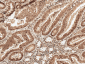 MCL 1 Antibody