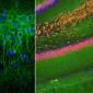 Anti-Microtubule Associated Protein 2 (MAP2) Antibody