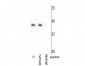 Anti-Mnk2b Antibody