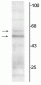 Anti-Thyroid Hormone Receptor, α1/α2-Isotype Antibody