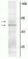 Anti-Thyroid Hormone Receptor, α1/α2-Isotype Antibody