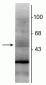 Anti-Retinoid X Receptor, ß-Isotype Antibody