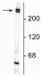 Anti-Nestin Antibody