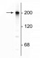 Anti-Neurofilament NF-H Antibody