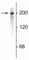 Anti-Neurofilament NF-H Antibody