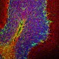 Anti-Neurofilament NF-H Antibody