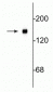 Anti-Neurofilament NF-M Antibody